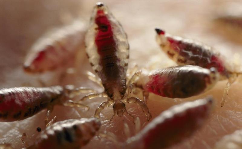 Средство от вшей